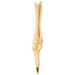 Knee Joint Bone Pen